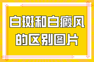 皮肤突然出现白斑-喝酒后皮肤出现白斑是怎么回事-怎么判断