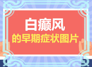 「排行榜单公布」脸上有一块一块的白斑？早期白斑有症状图片能吗