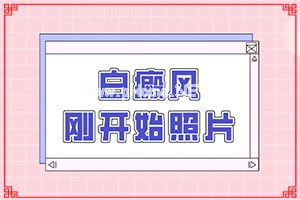 白癞风是怎么治[才能更好治疗]指端白癫风怎么治疗更好