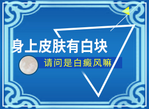 皮肤一块一块白色是什么病(都有哪些常见的特点呢)白斑的症状的图片